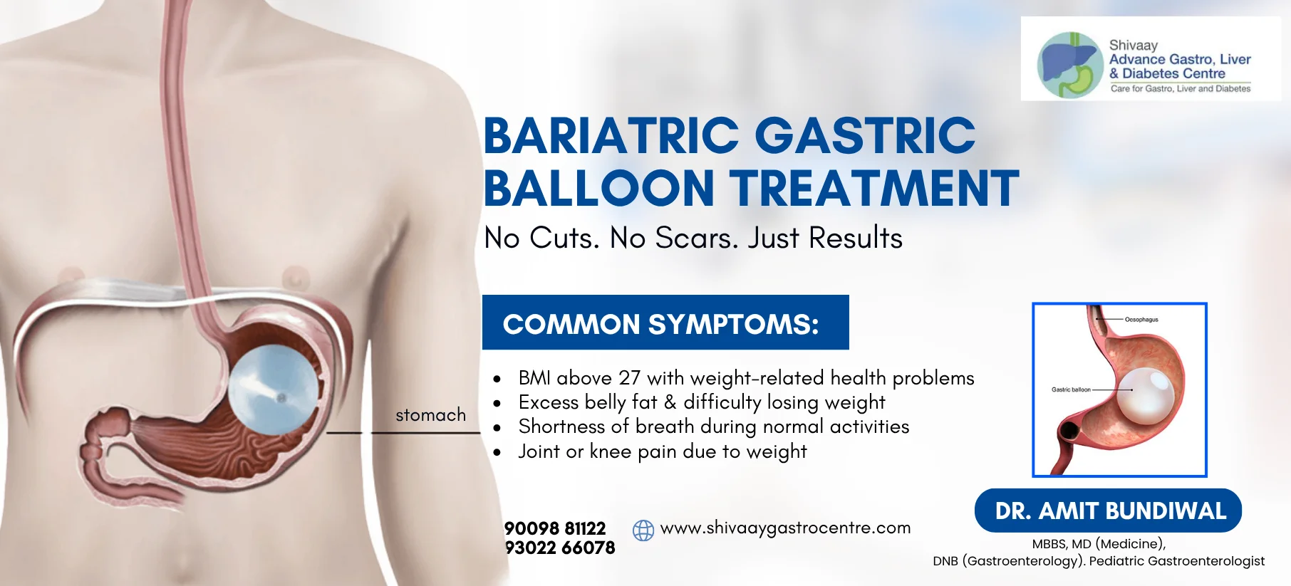 Shivaay advance gastro and liver centre