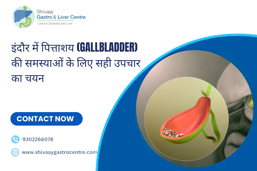 Gall Bladder Stones
